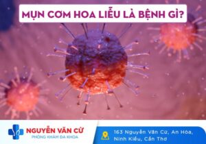 Mụn Cơm Hoa Liễu Là Gì? Dấu Hiệu Nhận Biết Và Cách Điều Trị