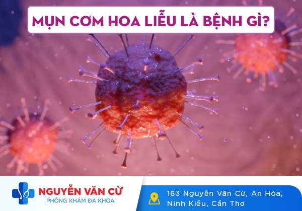 Mụn Cơm Hoa Liễu Là Gì? Dấu Hiệu Nhận Biết Và Cách Điều Trị