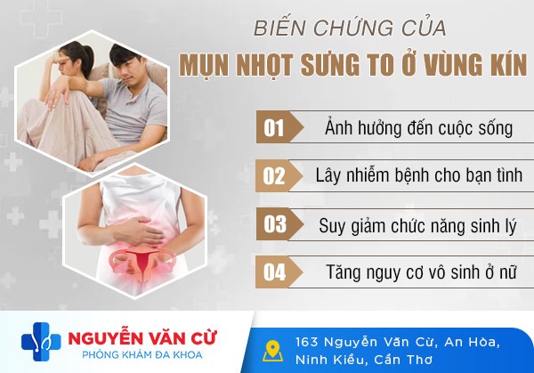 Cách Chữa Mụn Nhọt Sưng To Ở Vùng Kín Tại Nhà