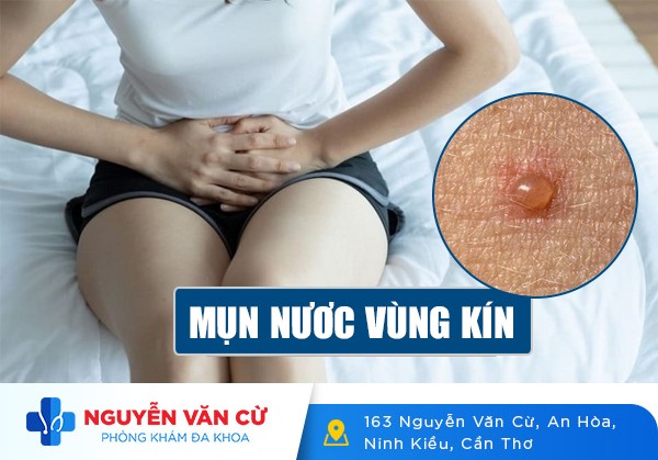 Mụn Nước Ở Vùng Kín Nguy Hiểm Không?