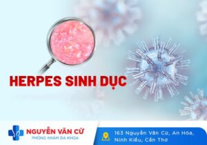 Bệnh Mụn Rộp Sinh Dục Nguy Hiểm Không? Điều Trị Bằng Cách Nào?