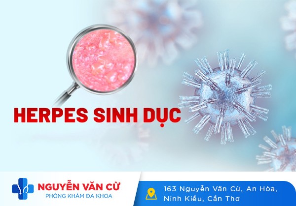 Bệnh Mụn Rộp Sinh Dục Nguy Hiểm Không? Điều Trị Bằng Cách Nào?