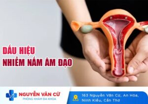 Dấu Hiệu Nhận Biết Nấm Âm Đạo Và Cách Chữa Trị Hiệu Quả