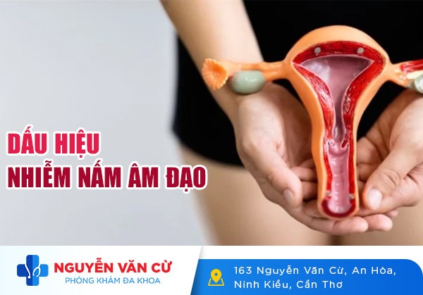 Dấu Hiệu Nhận Biết Nấm Âm Đạo Và Cách Chữa Trị Hiệu Quả
