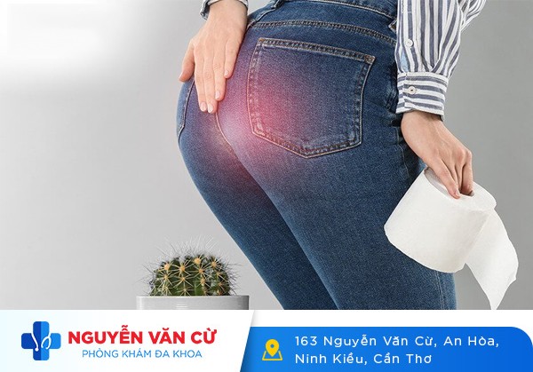Nguyên Nhân Gây Ngứa Hậu Môn Và Cách Điều Trị