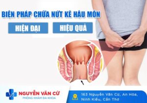 Những Cách Điều Trị Nứt Kẽ Hậu Môn Hiện Đại, Hiệu Quả