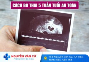 Cách Bỏ Thai 5 Tuần Tuổi An Toàn