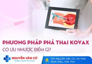 Phương pháp phá thai Kovax có ưu nhược điểm gì? Chi phí ra sao?