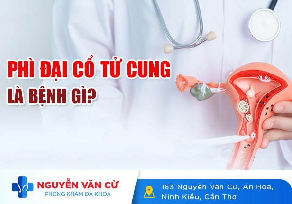 Phì Đại Cổ Tử Cung Là Bệnh Gì? Có Nguy Hiểm Không?