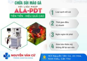 Phương Pháp Điều Trị Sùi Mào Gà ALA – PDT