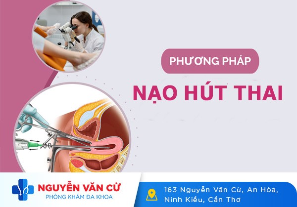 Phương Pháp Nạo Hút Thai An Toàn Không Đau