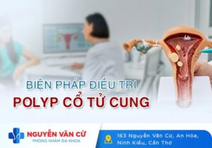 Điều Trị Polyp Cổ Tử Cung Sao Cho Nhanh Khỏi?