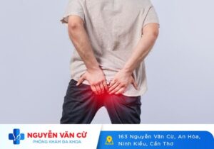 Polyp Hậu Môn Là Gì Dấu Hiệu Nhận Biết Và Cách Điều Trị
