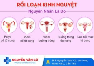 Kinh Nguyệt Không Đều Là Do Đâu?