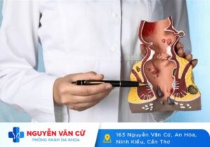Sa Búi Trĩ Là Gì Dấu Hiệu Nhận Biết Và Phương Pháp Điều Trị Sa Búi Trĩ