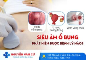 Siêu Âm Bụng Phát Hiện Được Những Bệnh Lý Nào?
