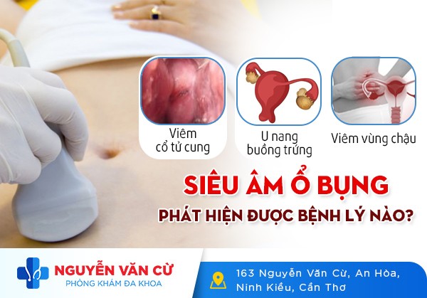 Siêu Âm Bụng Phát Hiện Được Những Bệnh Lý Nào?