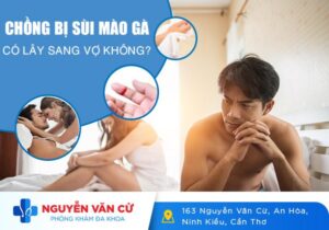 Chồng Bị Sùi Mào Gà Có Lây Sang Vợ Không? – Cùng Chuyên Gia Giải Đáp