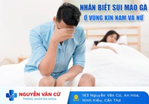 Nhận Biết Sùi Mào Gà Ở Vùng Kín Nam Và Nữ