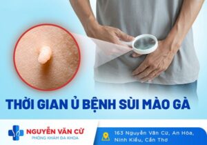 Thời Gian Ủ Bệnh Và Phát Bệnh Sùi Mào Gà Là Bao Lâu?
