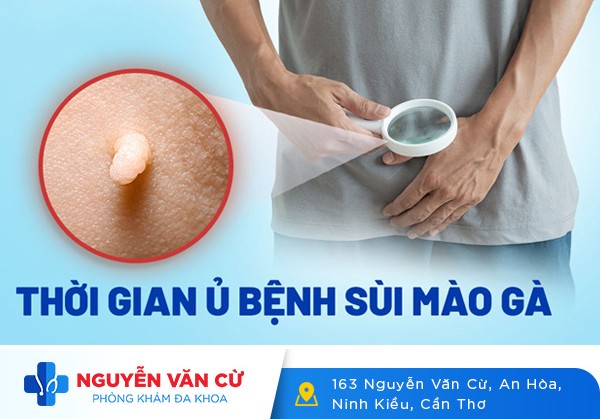 Thời Gian Ủ Bệnh Và Phát Bệnh Sùi Mào Gà Là Bao Lâu?
