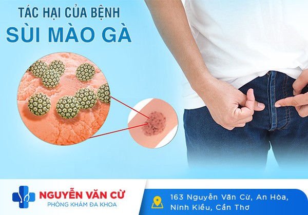Những Tác Hại Khôn Lường Của Sùi Mào Gà
