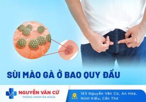 Triệu Chứng Sùi Mào Gà Ở Bao Quy Đầu Là Như Thế Nào?