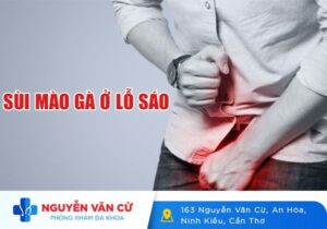 Nhận Biết Biểu Hiện Sùi Mào Gà Ở Lỗ Sáo