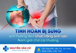 Nguyên Nhân Và Cách Điều Trị Tinh Hoàn Bị Sưng