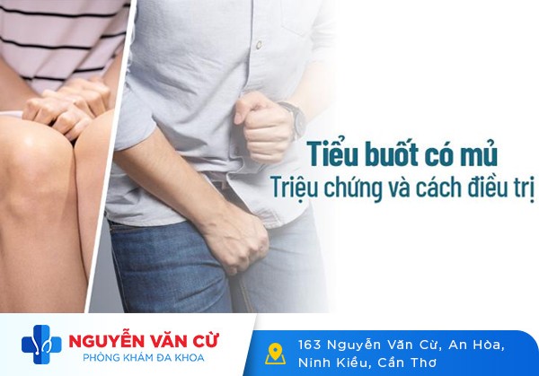 Tiểu Buốt Ra Mủ Cảnh Báo Bệnh Lý Nguy Hiểm