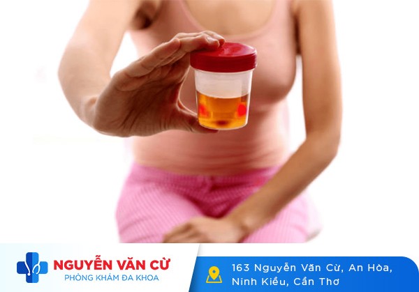 Nữ Bị Tiểu Buốt Ra Máu Đau Tức Bụng Dưới