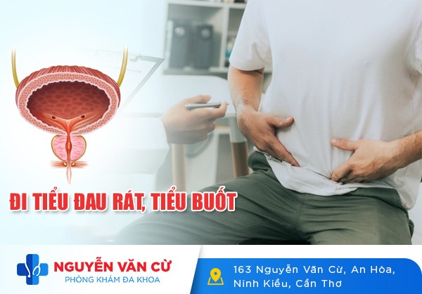 Đi Tiểu Đau Rát, Tiểu Buốt Bác Sĩ Chẩn Đoán Bệnh Gì?