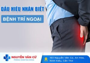 Dấu Hiệu Nhận Biết Bệnh Trĩ Ngoại