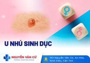 U Nhú Ở Bộ Phận Sinh Dục Nam Và Nữ Là Biểu Hiện Của Bệnh Gì?
