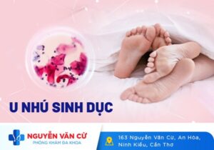 Triệu Chứng Nổi Cục U Nhú Ở Bộ Phận Sinh Dục Nam Và Nữ Là Bệnh Gì?