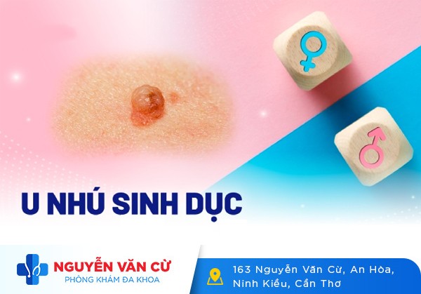 U Nhú Ở Bộ Phận Sinh Dục Nam Và Nữ Là Biểu Hiện Của Bệnh Gì?