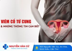Viêm Cổ Tử Cung – Dấu Hiệu, Nguyên Nhân, Cách Điều Trị