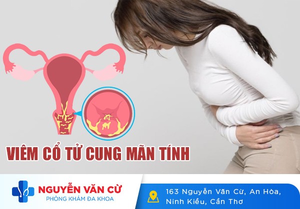 Cách Nhận Biết Viêm Cổ Tử Cung Mãn Tính