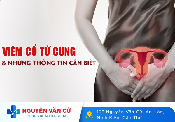 Viêm Cổ Tử Cung – Dấu Hiệu, Nguyên Nhân, Cách Điều Trị