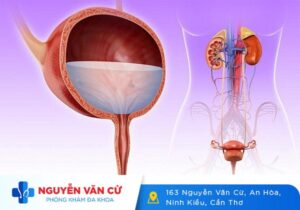 Tổng Quan Viêm Tiết Niệu Ở Nam Và Nữ