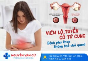 Cách Nhận Biết Dấu Hiệu Bệnh Viêm Lộ Tuyến Cổ Tử Cung