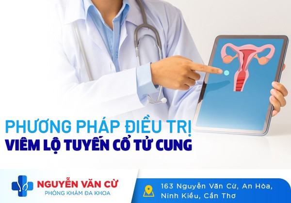 Điều Trị Viêm Lộ Tuyến Cổ Tử Cung Ở Từng Cấp Độ Như Thế Nào?