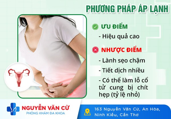 Điều Trị Viêm Lộ Tuyến Cổ Tử Cung Bằng Phương Pháp Áp Lạnh
