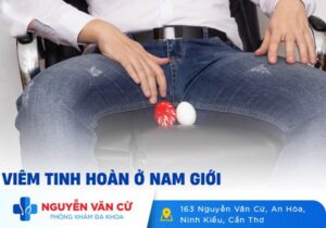 Cách Điều Trị Viêm Tinh Hoàn Cho Nam Giới