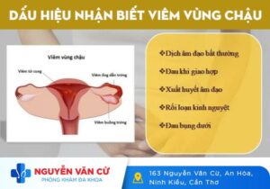 Viêm Vùng Chậu Có Nguy Hiểm Không?