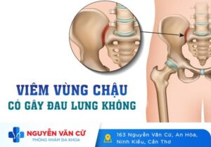 Đau Nhức Mỏi Lưng Dấu Hiệu Viêm Vùng Chậu