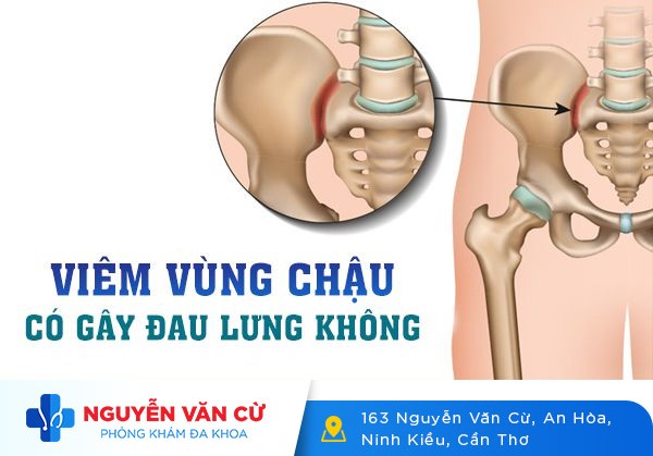 Đau Nhức Mỏi Lưng Dấu Hiệu Viêm Vùng Chậu