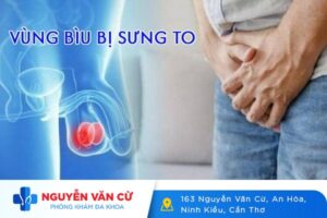 Vùng Bìu Ở Nam Giới Bị Sưng To Và Cách Chữa