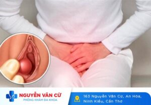 Vùng Kín Nổi Hột Không Ngứa Nguyên Nhân, Hướng Xử Trí Và Biện Pháp Phòng Ngừa