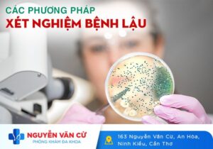 Các Phương Pháp Xét Nghiệm Bệnh Lậu Hiện Nay